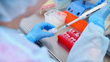 Journée mondiale contre le sida 2025 : l'épidémie de VIH est restée stable en France en 2024, mais continue d'inquiéter