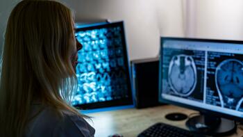 Radiologues : pourquoi vous risquez de trouver portes closes ce lundi ?
